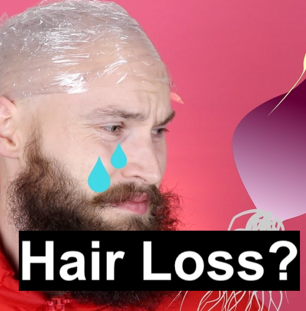 How to Prevent Male Hair Loss?